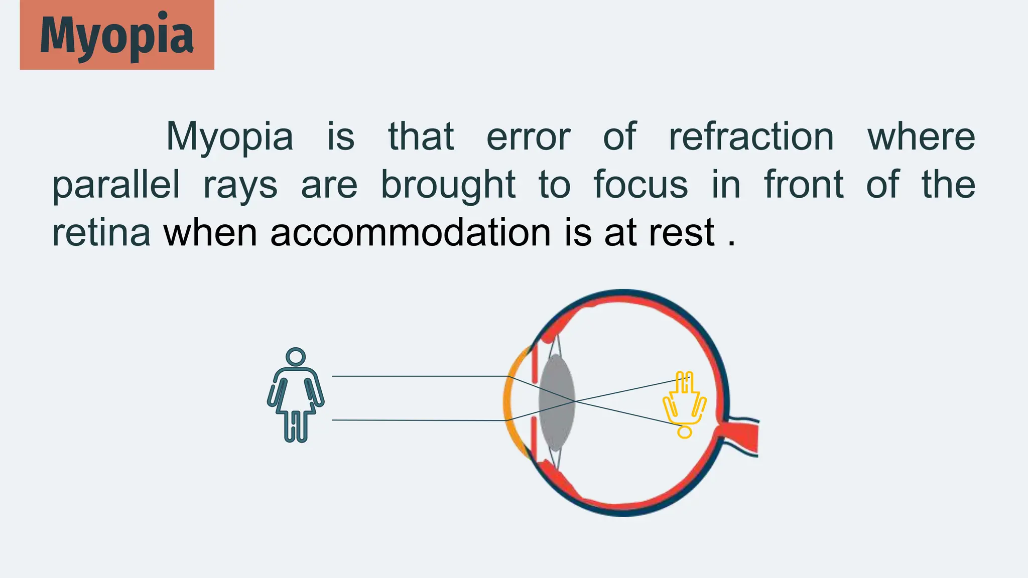 Myopia is that error of refraction where
parallel rays are brought to focus in front of the
retina when accommodation is at rest .
Myopia
 
