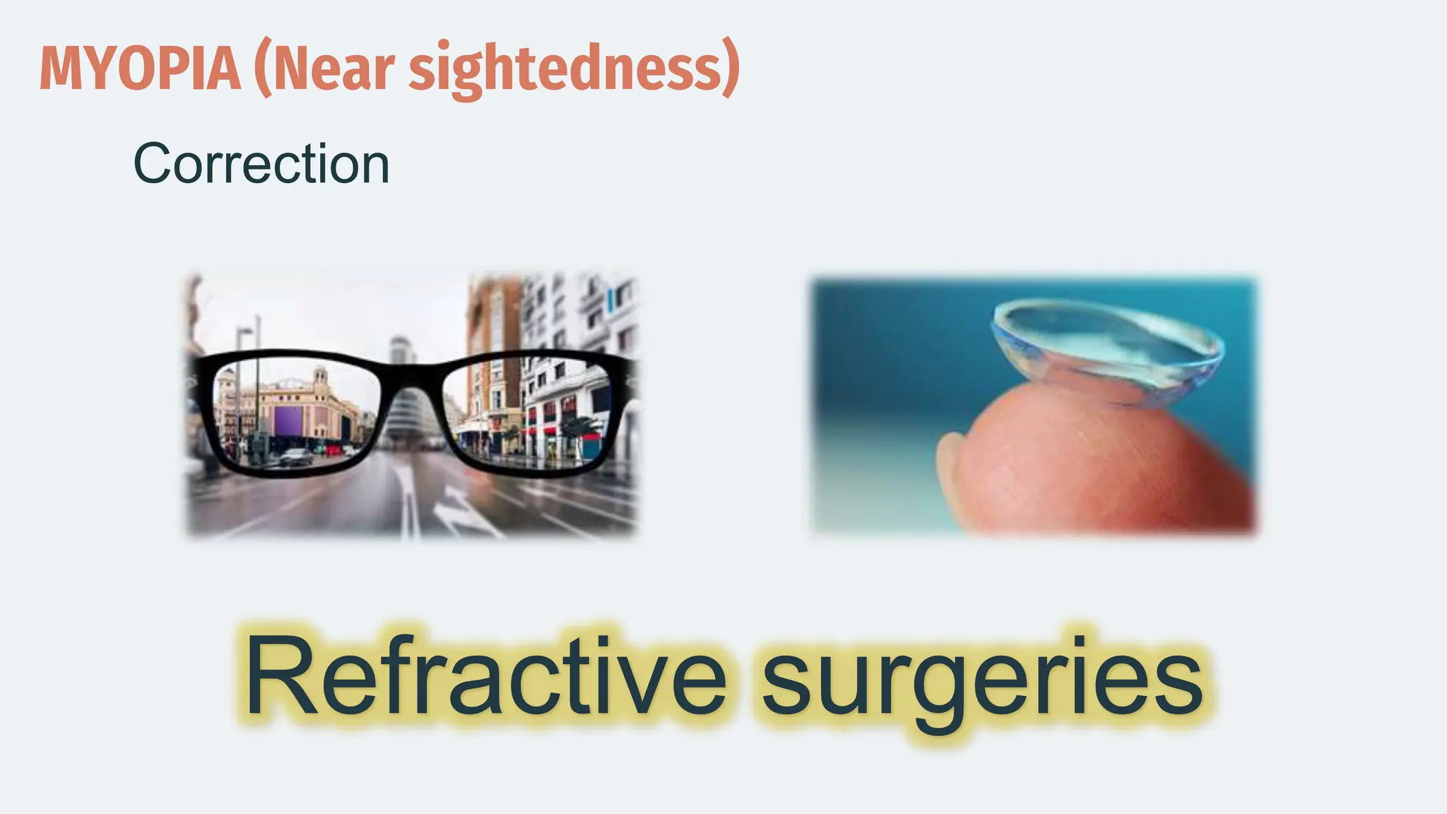 MYOPIA (Near sightedness)
Correction
Refractive surgeries
 