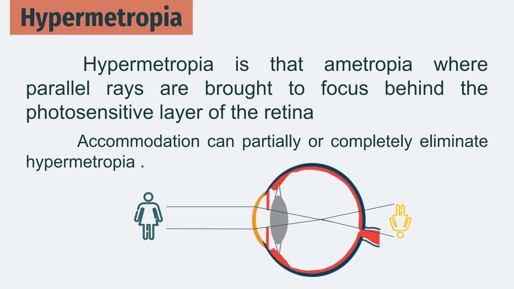 Hypermetropia is that ametropia where
parallel rays are brought to focus behind the
photosensitive layer of the retina
Accommodation can partially or completely eliminate
hypermetropia .
Hypermetropia
 