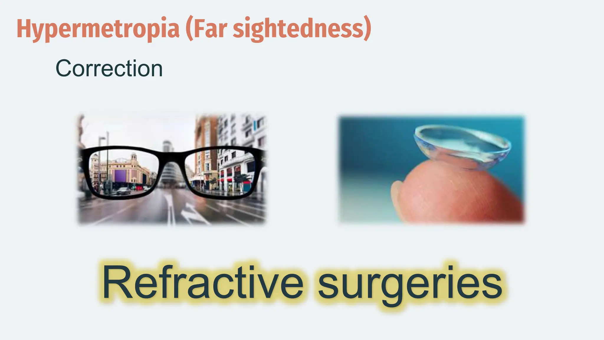 Hypermetropia (Far sightedness)
Correction
Refractive surgeries
 