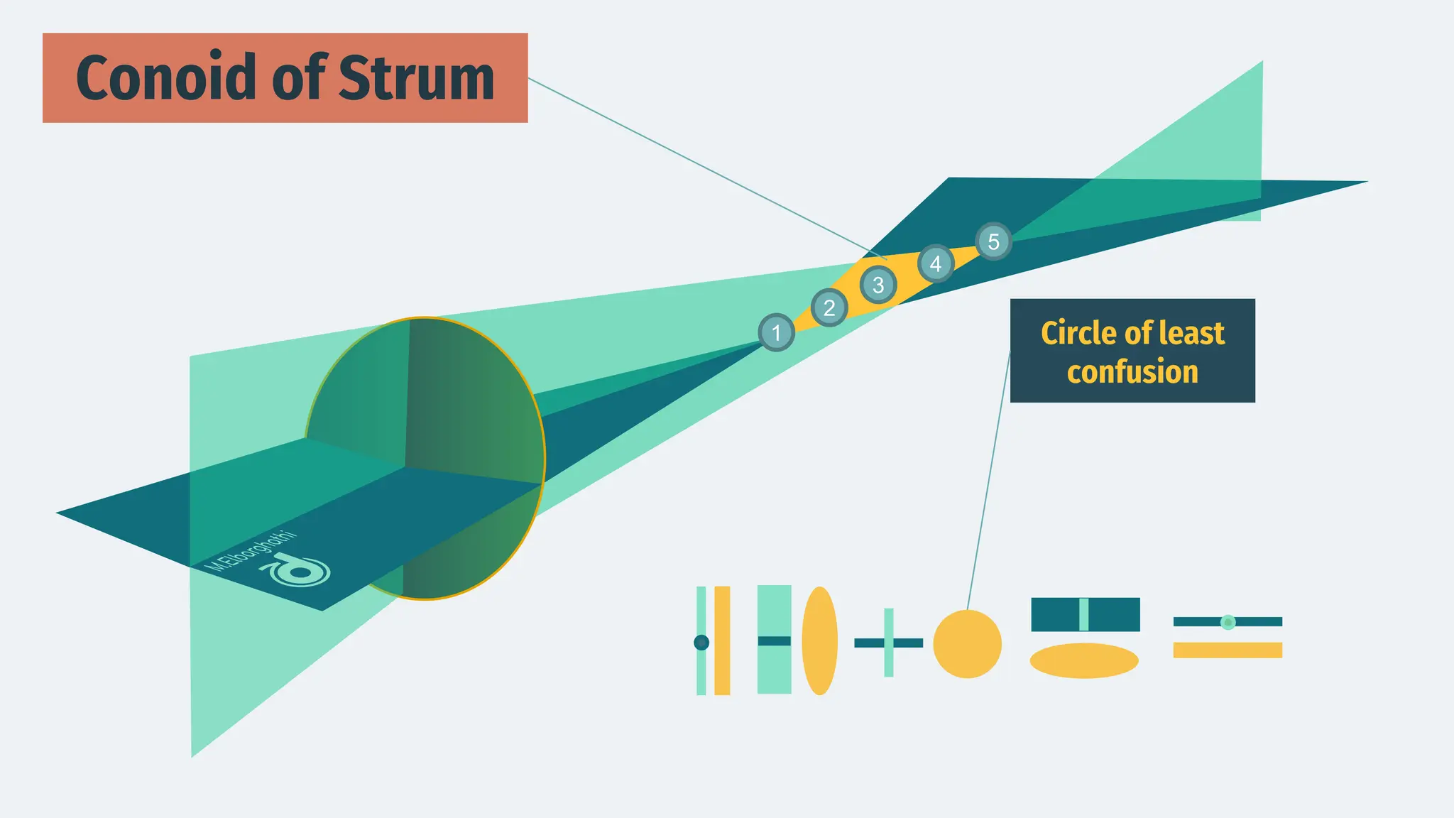 Circle of least
confusion
1
2
3
4
5
Conoid of Strum
 