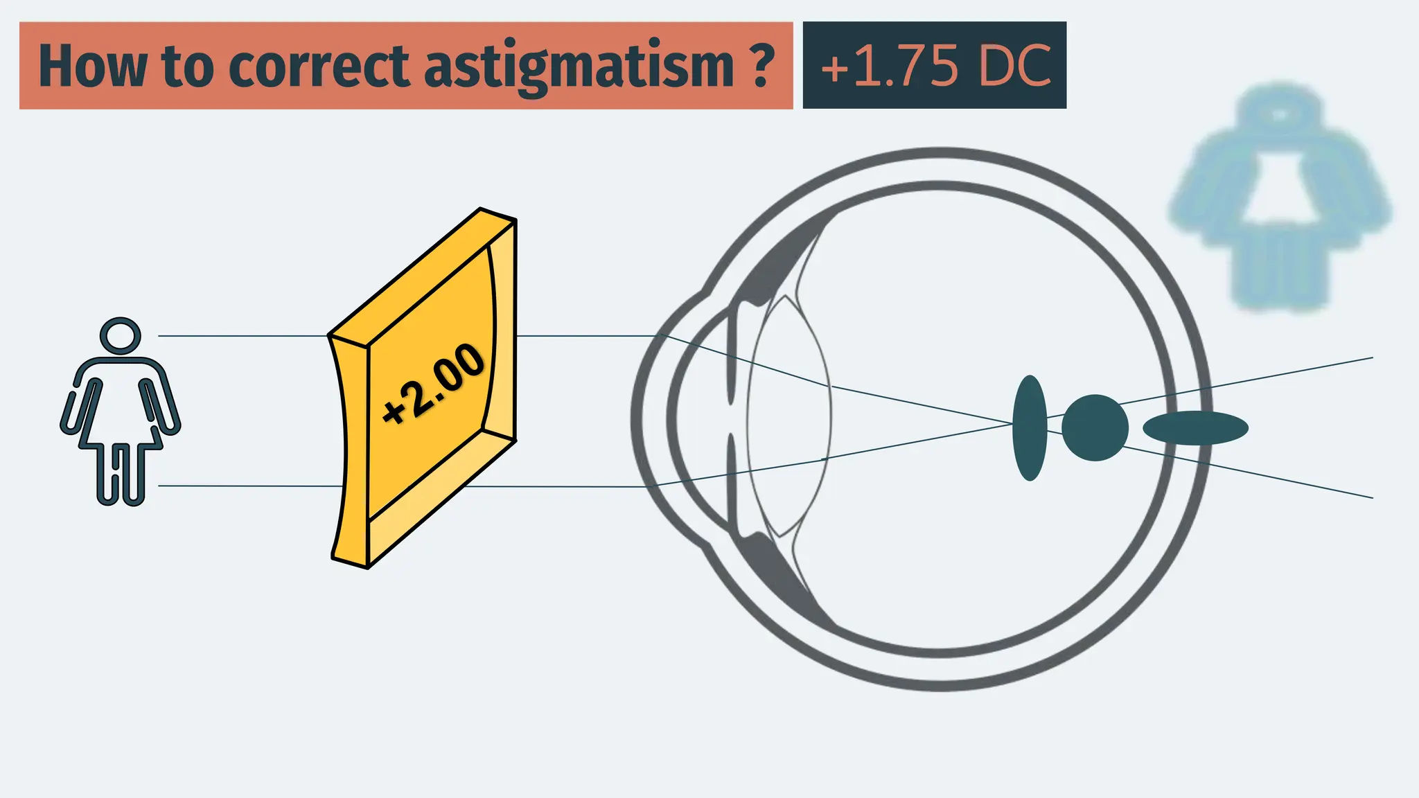How to correct astigmatism ? +1.75 DC
 