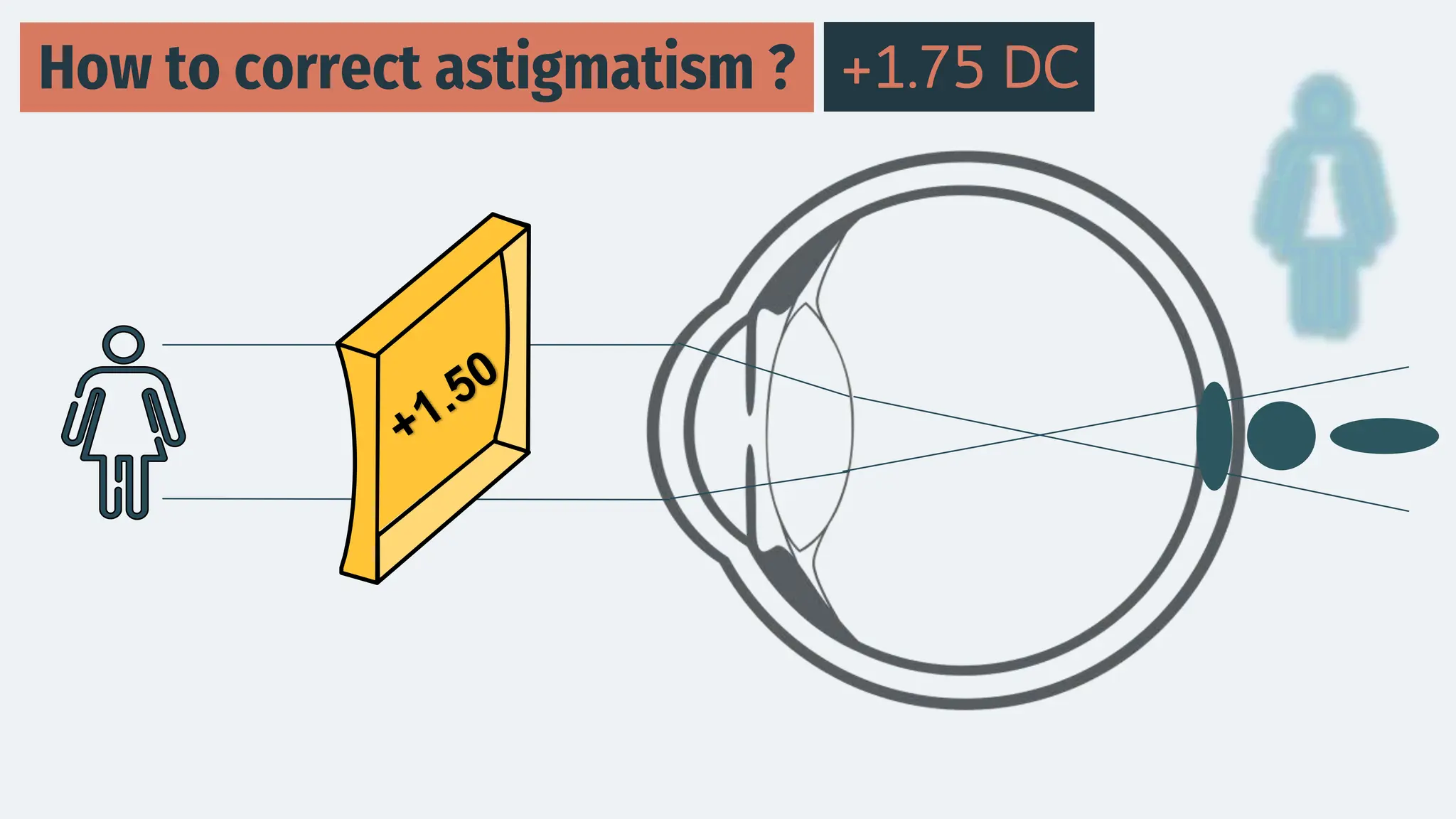 How to correct astigmatism ? +1.75 DC
 