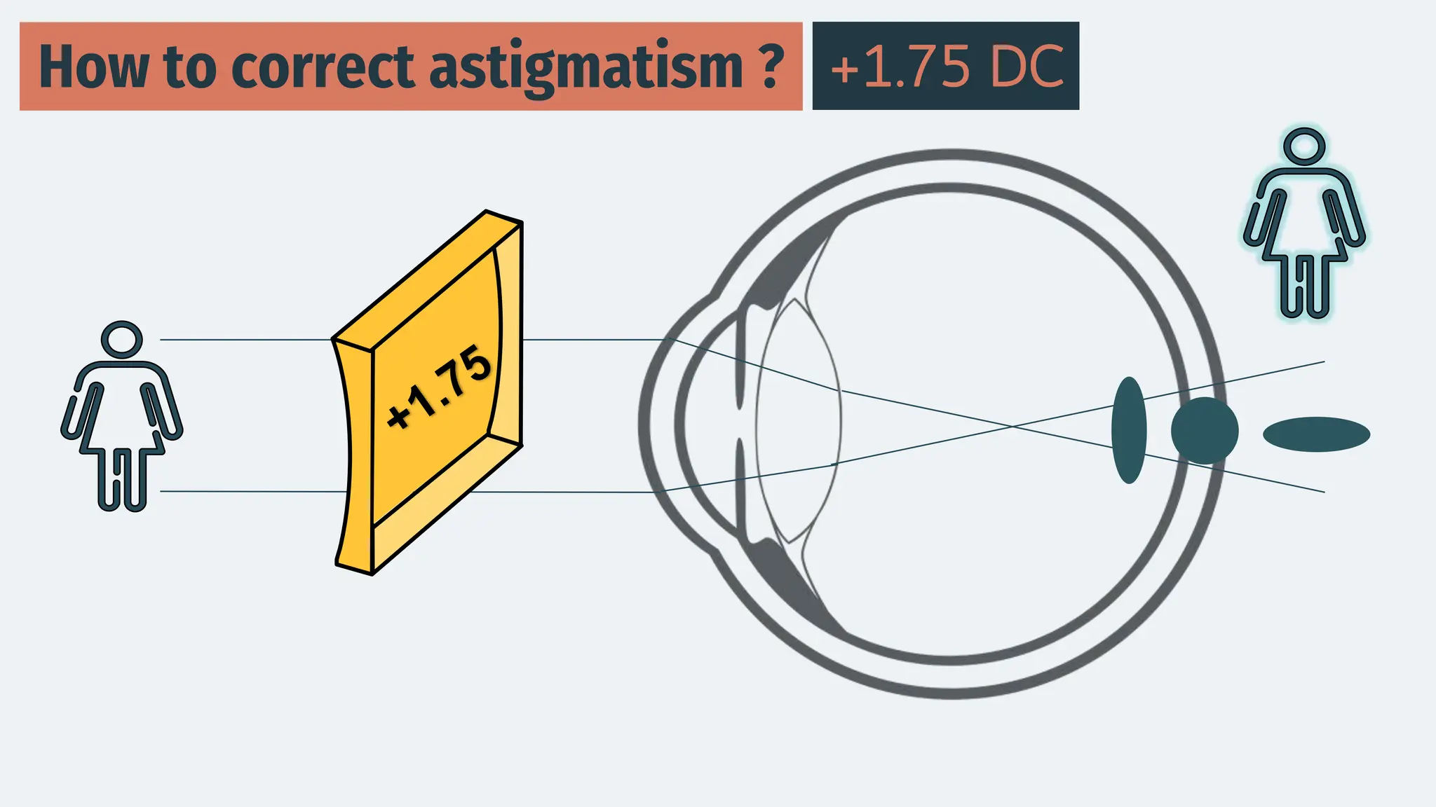 How to correct astigmatism ? +1.75 DC
 