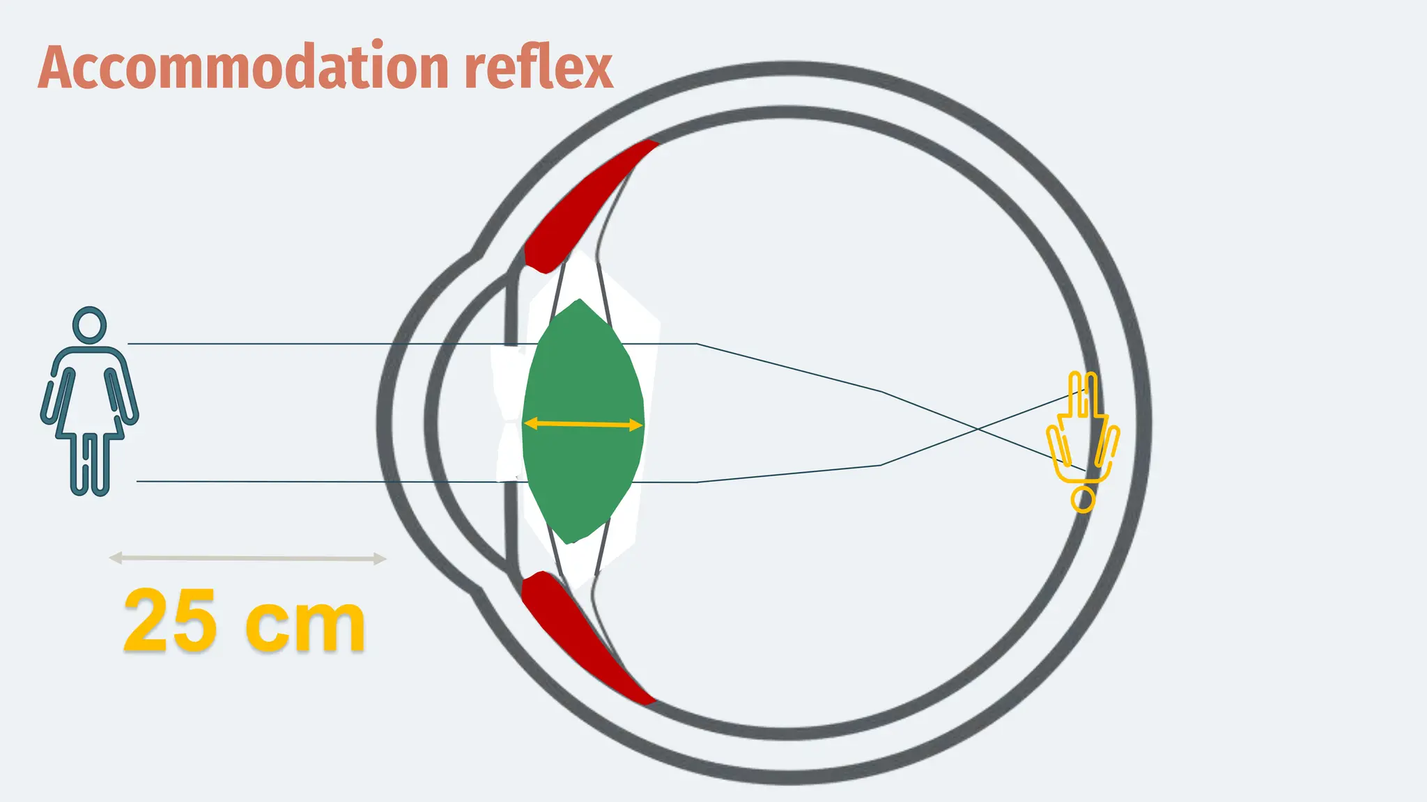 Accommodation reflex
25 cm
 