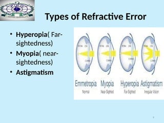 9
Types of Refractive Error
• Hyperopia( Far-
sightedness)
• Myopia( near-
sightedness)
• Astigmatism
 
