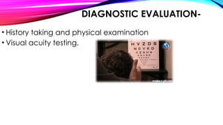 DIAGNOSTIC EVALUATION-
• History taking and physical examination
• Visual acuity testing.
 