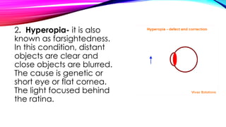 2. Hyperopia- it is also
known as farsightedness.
In this condition, distant
objects are clear and
close objects are blurred.
The cause is genetic or
short eye or flat cornea.
The light focused behind
the ratina.
 