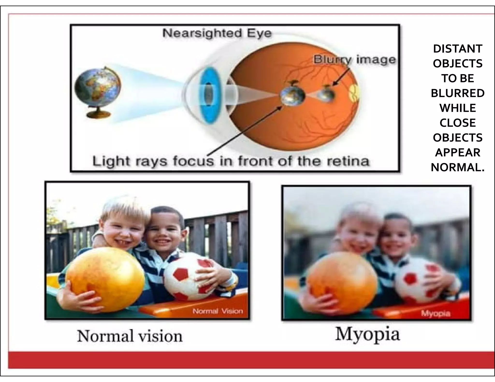 DISTANT
OBJECTS
TO BE
BLURRED
WHILE
CLOSE
OBJECTS
APPEAR
NORMAL.
 