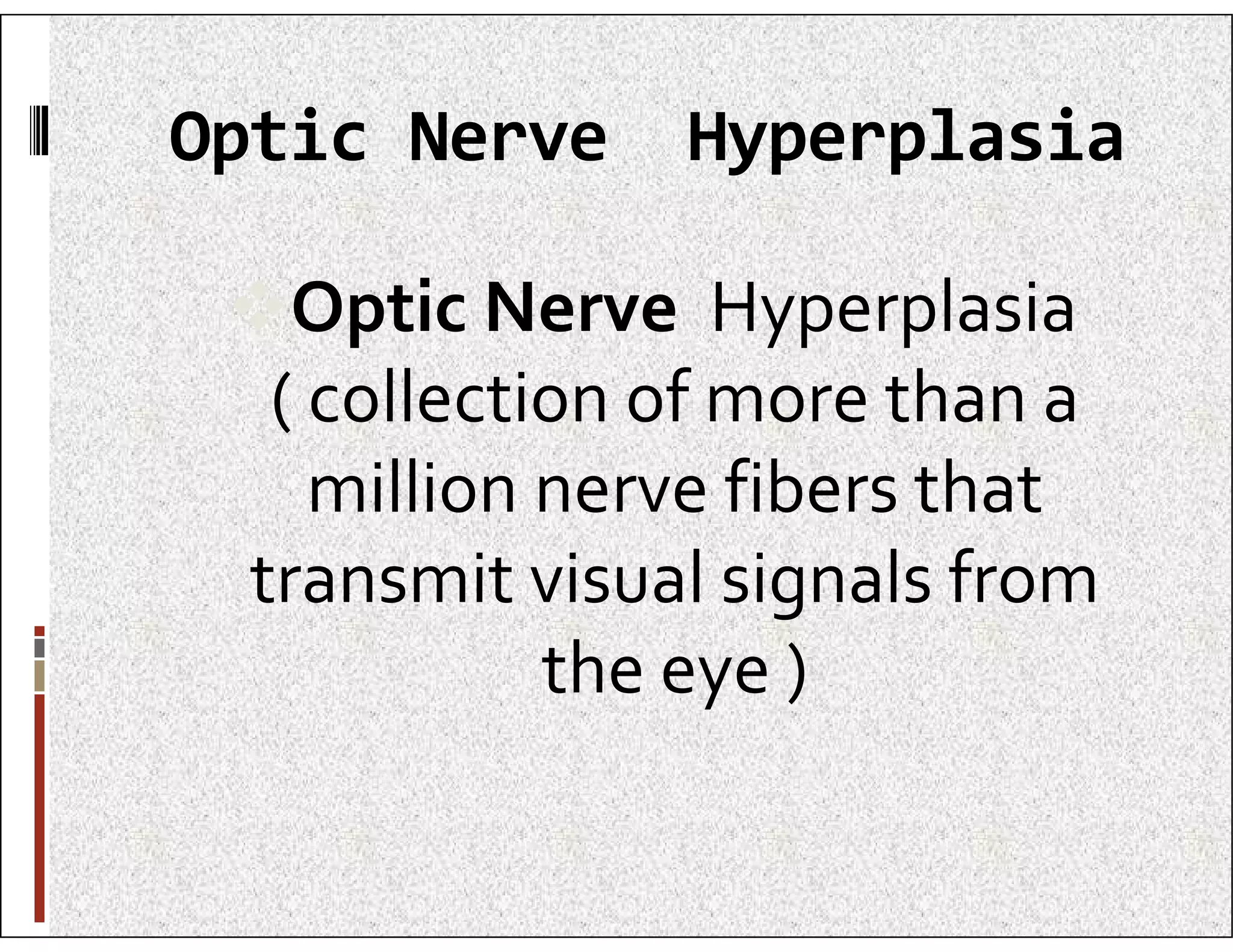 Optic Nerve Hyperplasia
Optic Nerve Hyperplasia
( collection of more than a
million nerve fibers that
million nerve fibers that
transmit visual signals from
the eye )
 