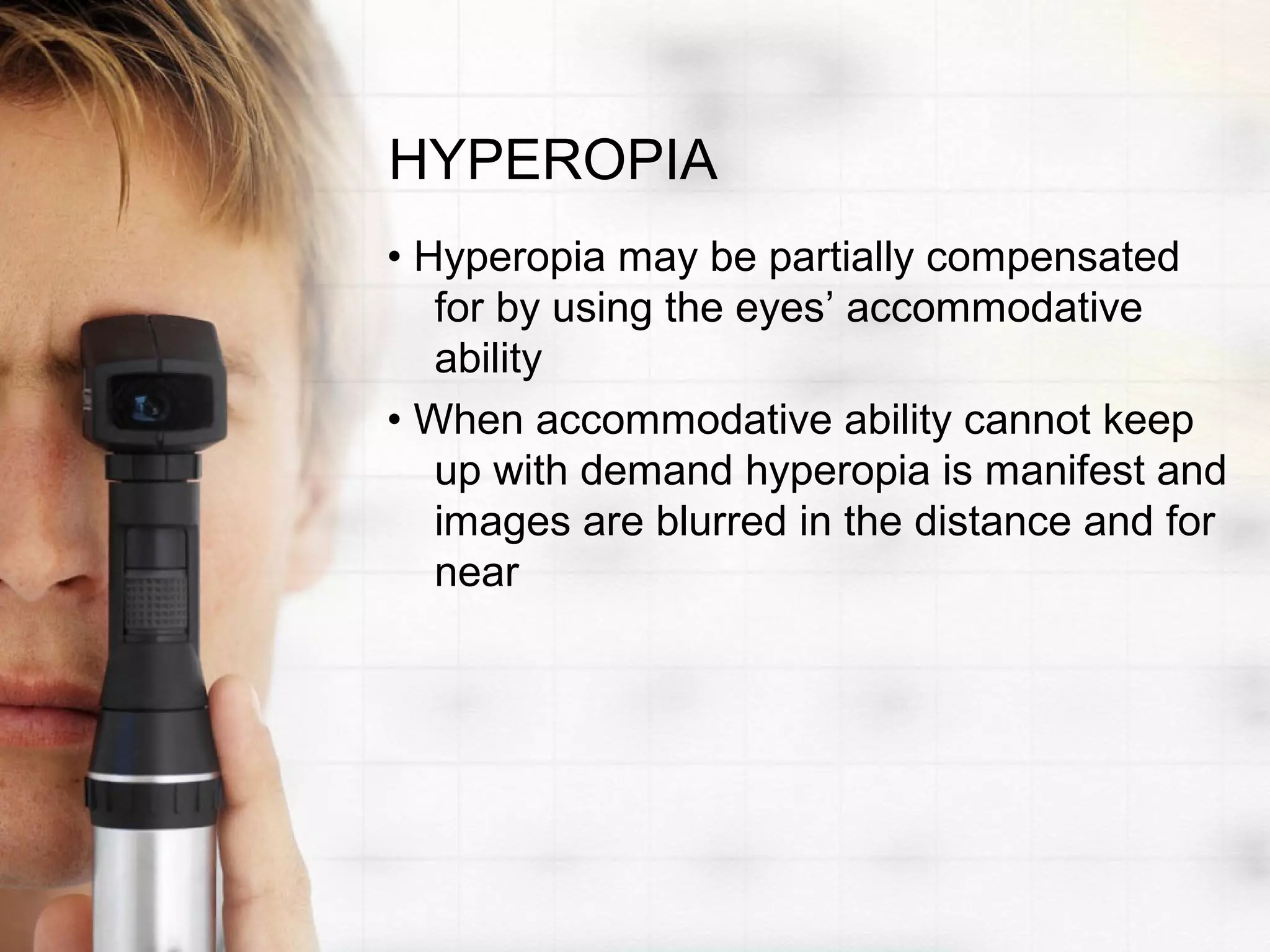 HYPEROPIA
• Hyperopia may be partially compensated
for by using the eyes’ accommodative
ability
• When accommodative ability cannot keep
up with demand hyperopia is manifest and
images are blurred in the distance and for
near
 