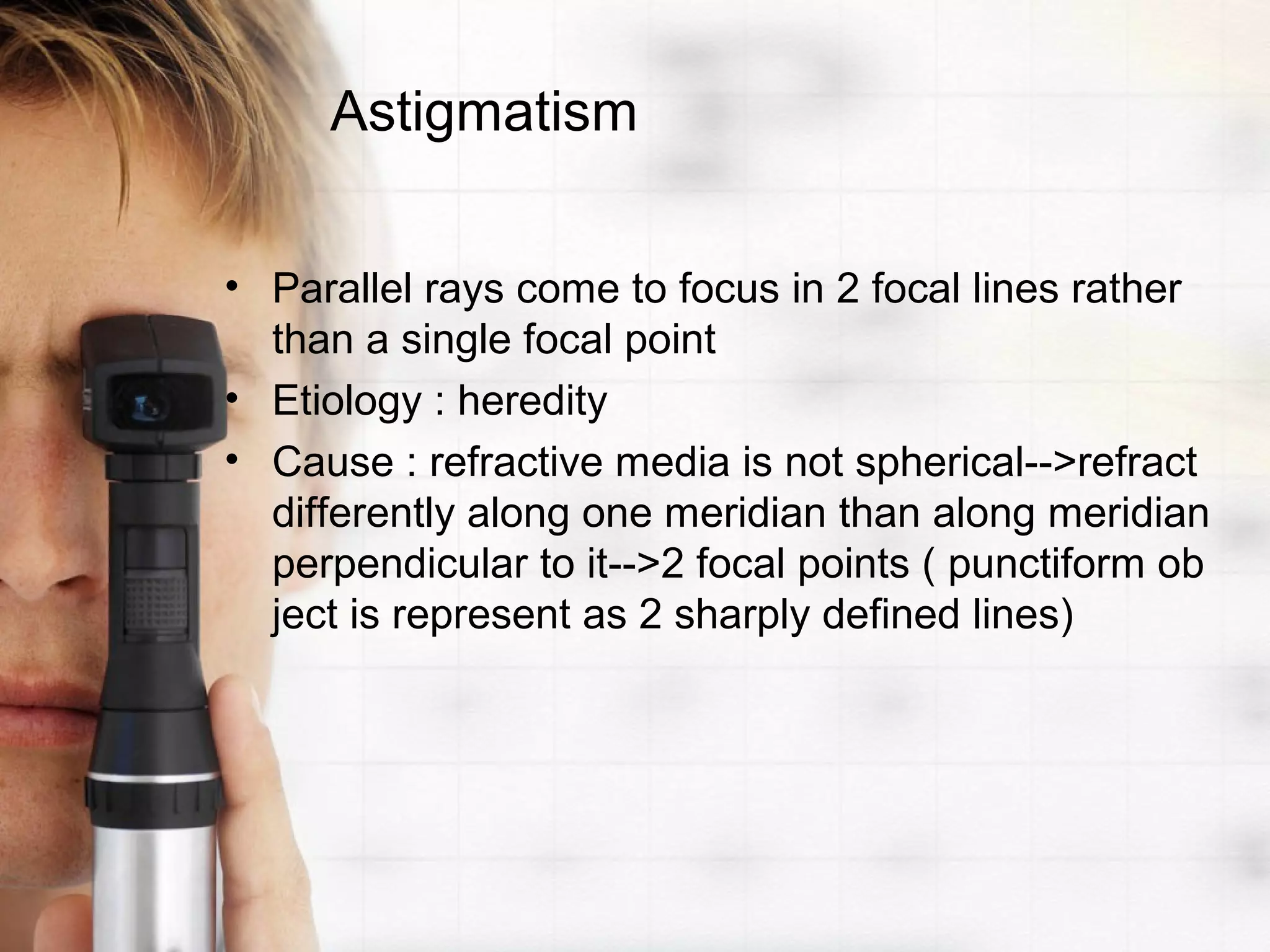 Astigmatism
• Parallel rays come to focus in 2 focal lines rather
than a single focal point
• Etiology : heredity
• Cause : refractive media is not spherical-->refract
differently along one meridian than along meridian
perpendicular to it-->2 focal points ( punctiform ob
ject is represent as 2 sharply defined lines)
 