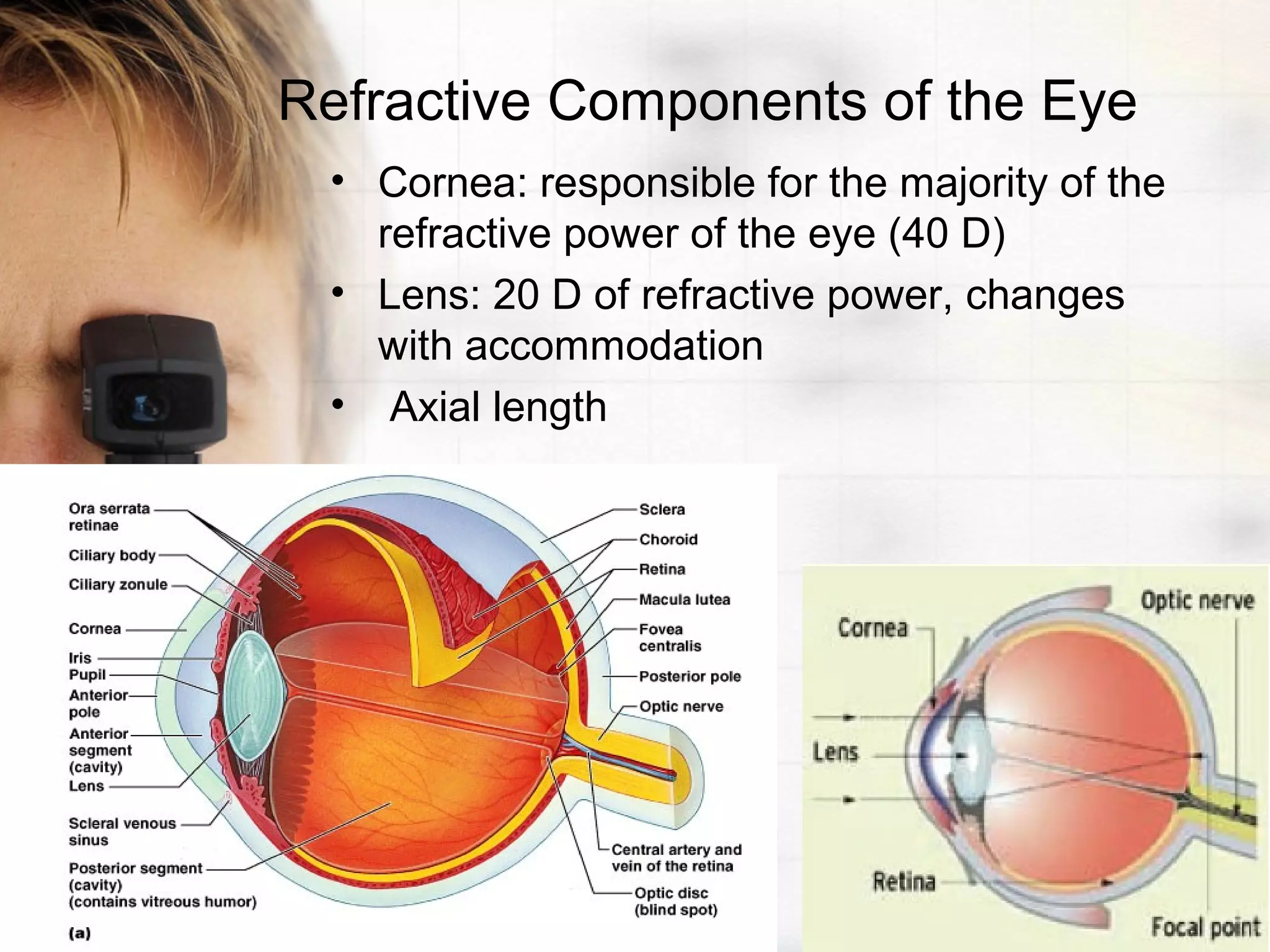Refractive Components of the Eye
• Cornea: responsible for the majority of the
refractive power of the eye (40 D)
• Lens: 20 D of refractive power, changes
with accommodation
• Axial length
 