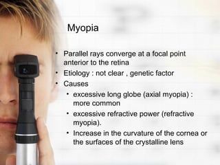 Myopia

• Parallel rays converge at a focal point
  anterior to the retina
• Etiology : not clear , genetic factor
• Causes
   • excessive long globe (axial myopia) :
     more common
   • excessive refractive power (refractive
     myopia).
   • Increase in the curvature of the cornea or
     the surfaces of the crystalline lens
 