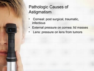 Pathologic Causes of
Astigmatism
•  Corneal: post surgical, traumatic,
  infectious
• External pressure on cornea: lid masses
• Lens: pressure on lens from tumors
 