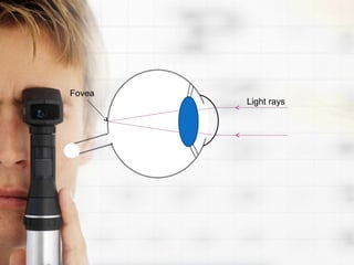 Fovea
        Light rays
 