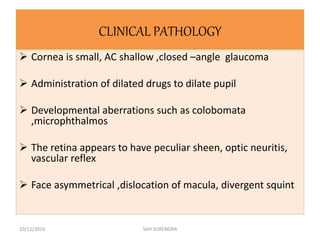 CLINICAL PATHOLOGY
 Cornea is small, AC shallow ,closed –angle glaucoma
 Administration of dilated drugs to dilate pupil
 Developmental aberrations such as colobomata
,microphthalmos
 The retina appears to have peculiar sheen, optic neuritis,
vascular reflex
 Face asymmetrical ,dislocation of macula, divergent squint
10/12/2016 SAH SURENDRA
 