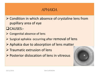 APHAKIA
 Condition in which absence of crystaline lens from
pupillary area of eye
CAUSES:-
 Congenital absence of lens
 Surgical aphakia occurring after removal of lens
 Aphakia due to absorption of lens matter
 Traumatic extrusion of lens
 Posterior dislocation of lens in vitreous
10/12/2016 SAH SURENDRA
 