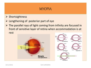 MYOPIA
 Shortsightness
 Lengthening of posterior part of eye
 The parallel rays of light coming from infinity are focused in
front of sensitive layer of retina when accommodation is at
rest
10/12/2016 SAH SURENDRA
 
