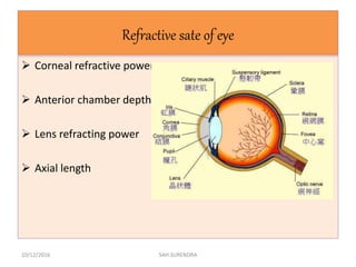 Refractive sate of eye
 Corneal refractive power
 Anterior chamber depth
 Lens refracting power
 Axial length
10/12/2016 SAH SURENDRA
 
