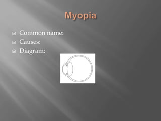  Common name:
 Causes:
 Diagram:
 