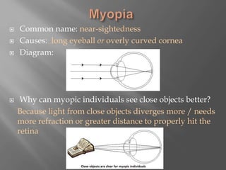  Common name: near-sightedness
 Causes: long eyeball or overly curved cornea
 Diagram:
 Why can myopic individuals see close objects better?
Because light from close objects diverges more / needs
more refraction or greater distance to properly hit the
retina
 