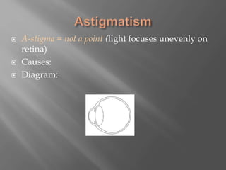  A-stigma = not a point (light focuses unevenly on
retina)
 Causes:
 Diagram:
 