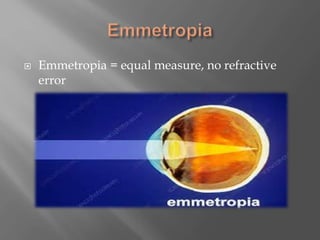  Emmetropia = equal measure, no refractive
error
 