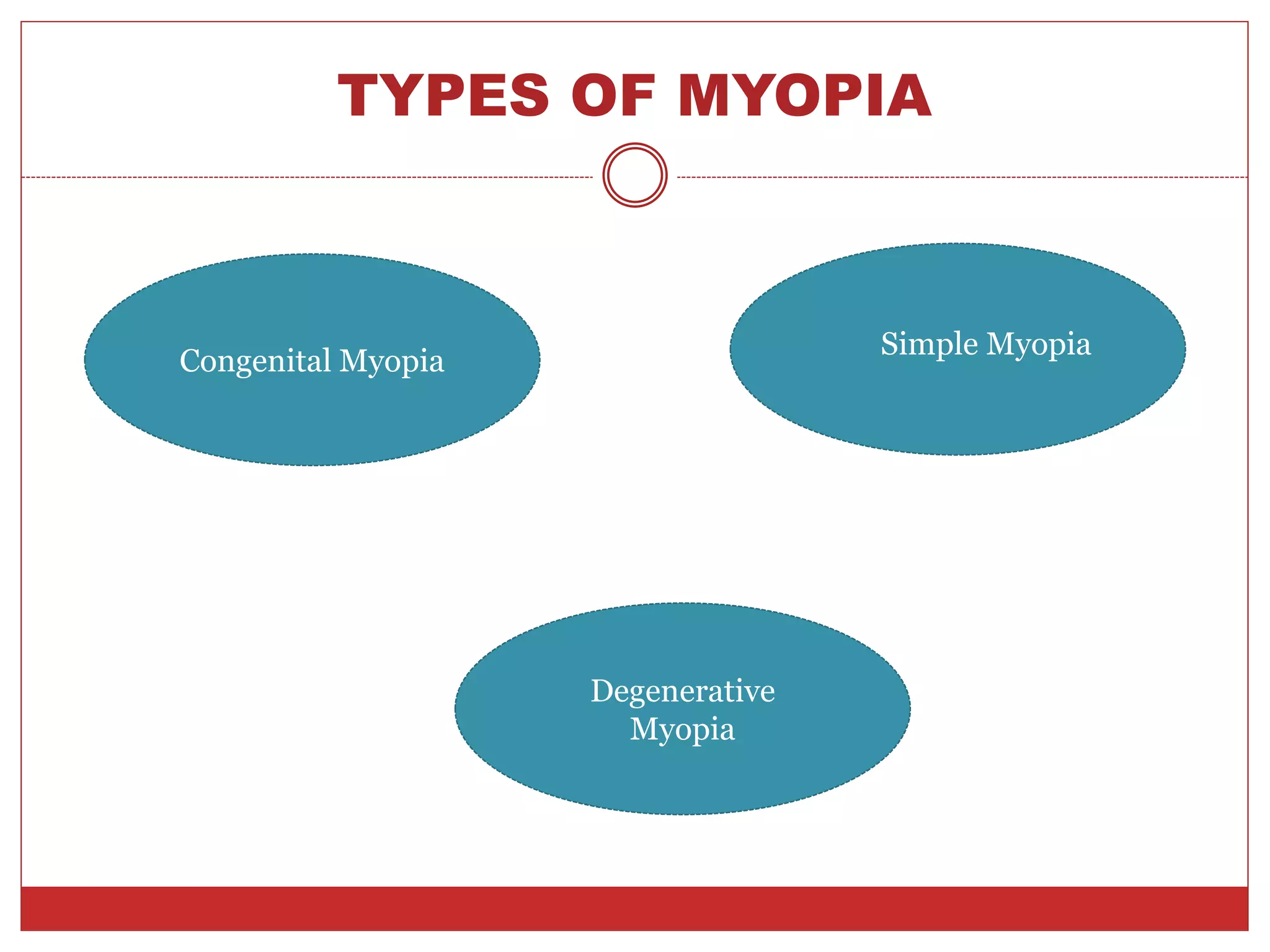 TYPES OF MYOPIA
Congenital Myopia
Degenerative
Myopia
Simple Myopia
 