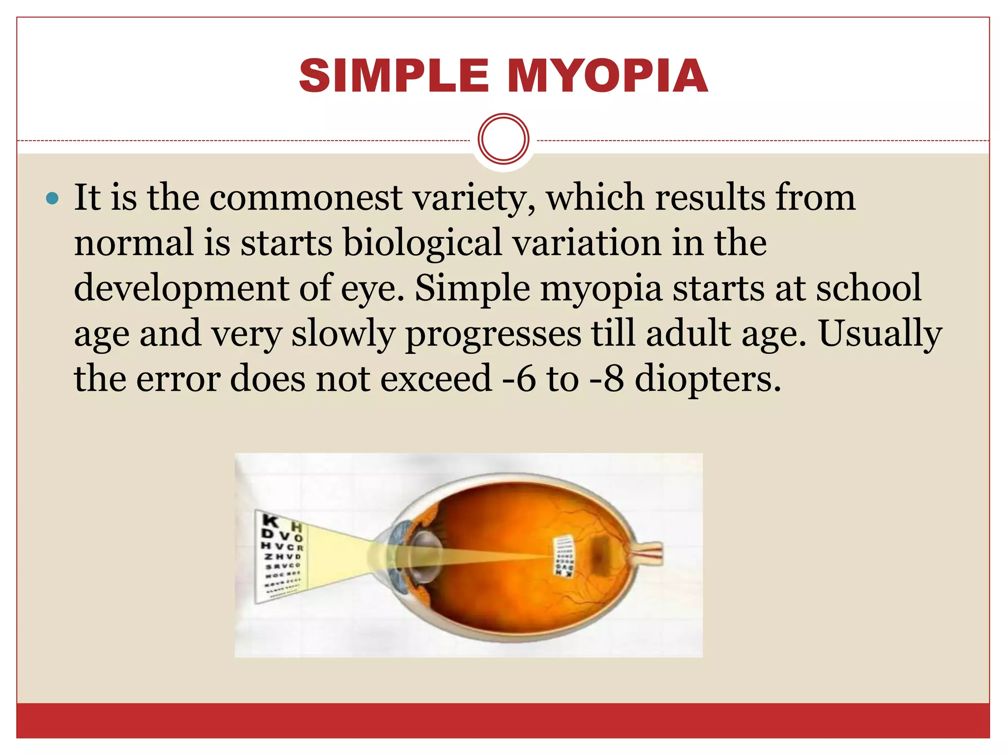 SIMPLE MYOPIA
 It is the commonest variety, which results from
normal is starts biological variation in the
development of eye. Simple myopia starts at school
age and very slowly progresses till adult age. Usually
the error does not exceed -6 to -8 diopters.
 