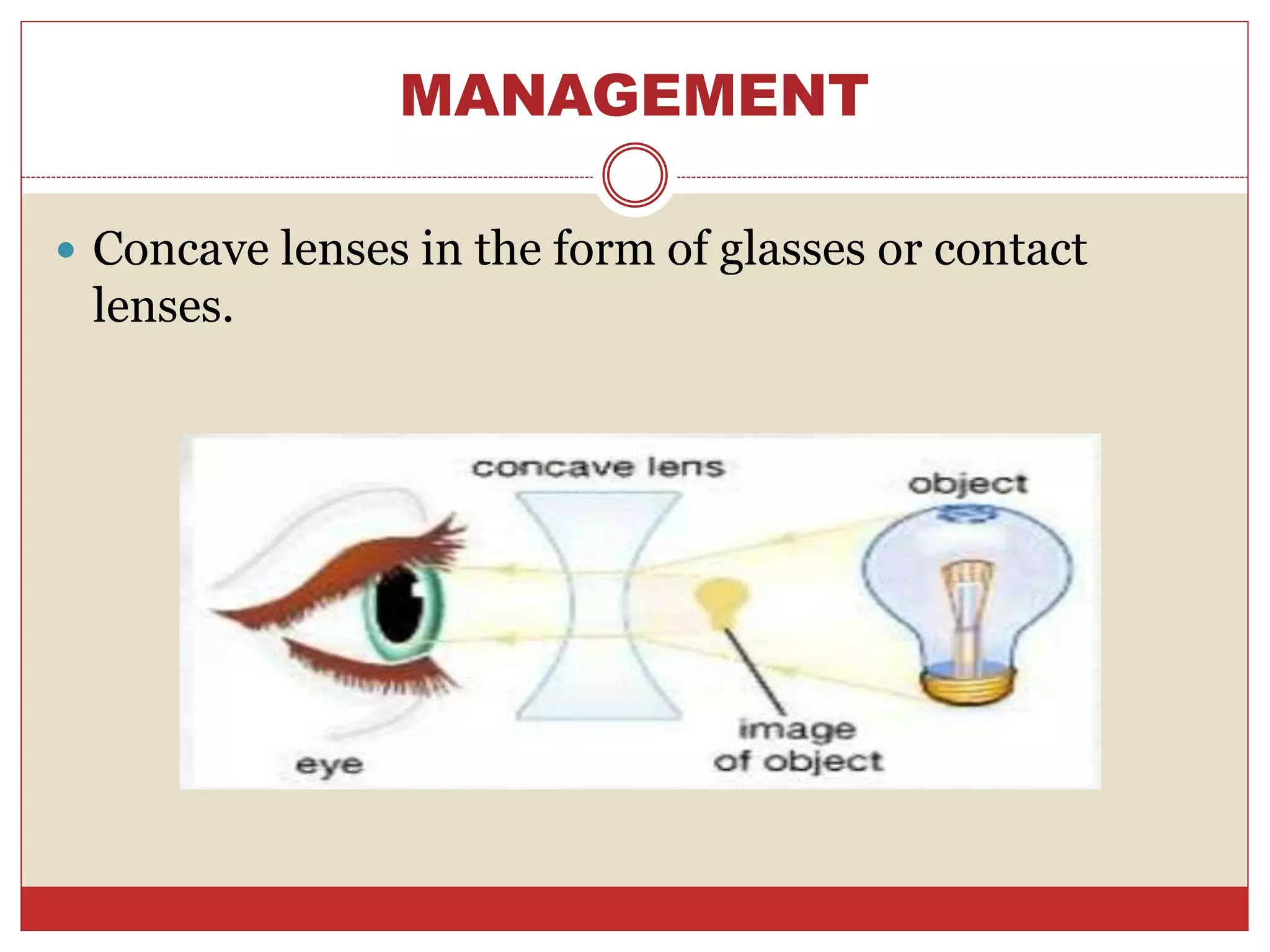 MANAGEMENT
 Concave lenses in the form of glasses or contact
lenses.
 