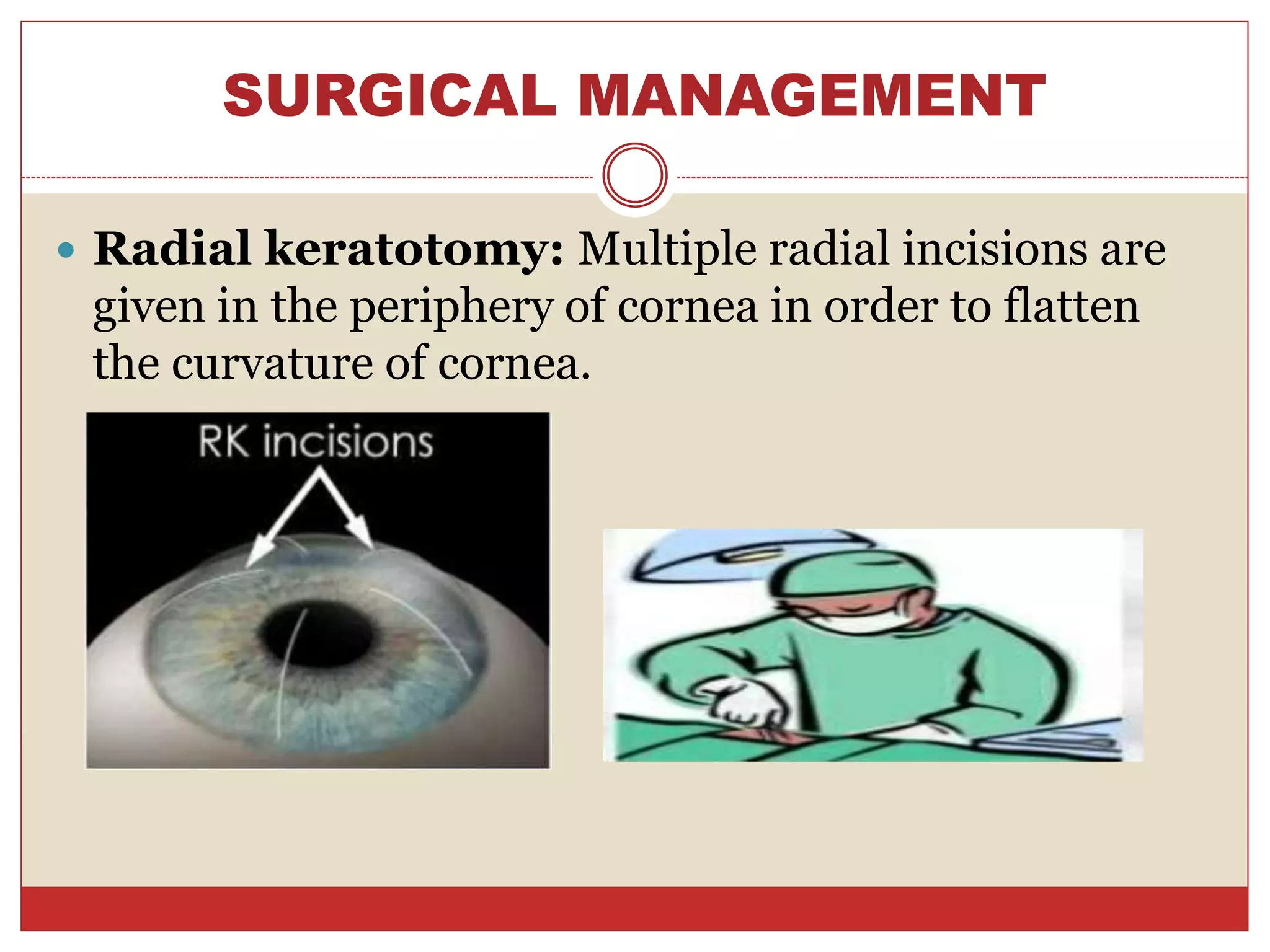 SURGICAL MANAGEMENT
 Radial keratotomy: Multiple radial incisions are
given in the periphery of cornea in order to flatten
the curvature of cornea.
 