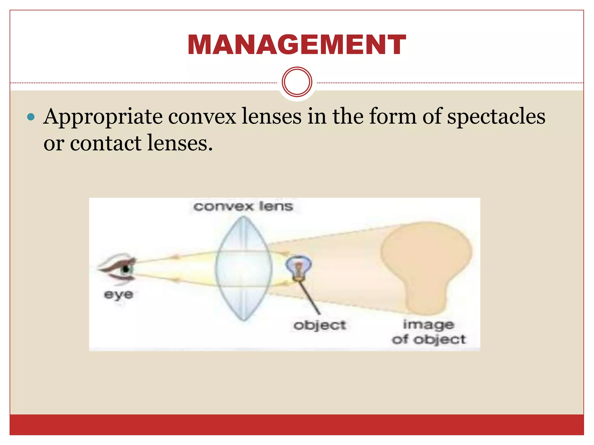 MANAGEMENT
 Appropriate convex lenses in the form of spectacles
or contact lenses.
 