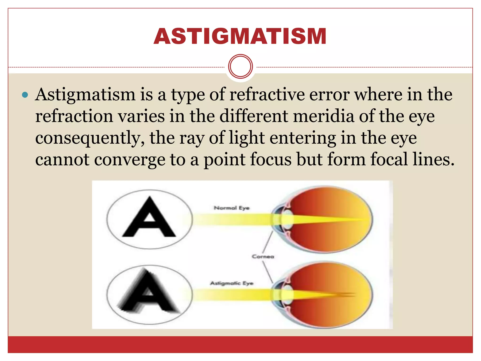 ASTIGMATISM
 Astigmatism is a type of refractive error where in the
refraction varies in the different meridia of the eye
consequently, the ray of light entering in the eye
cannot converge to a point focus but form focal lines.
 