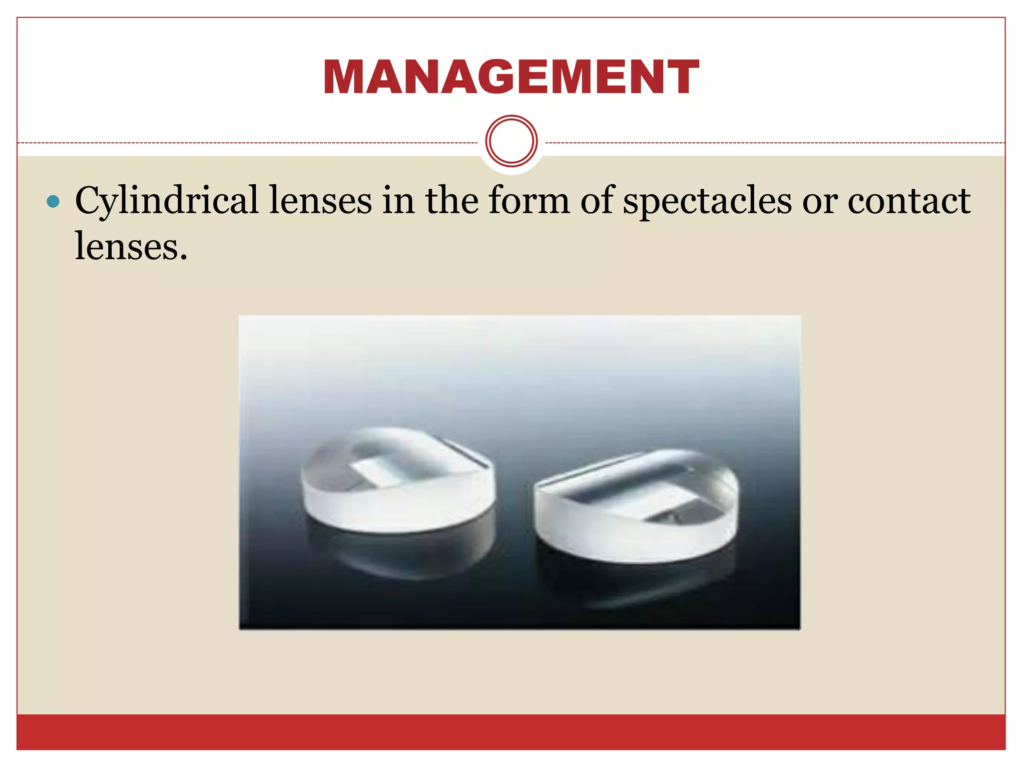MANAGEMENT
 Cylindrical lenses in the form of spectacles or contact
lenses.
 