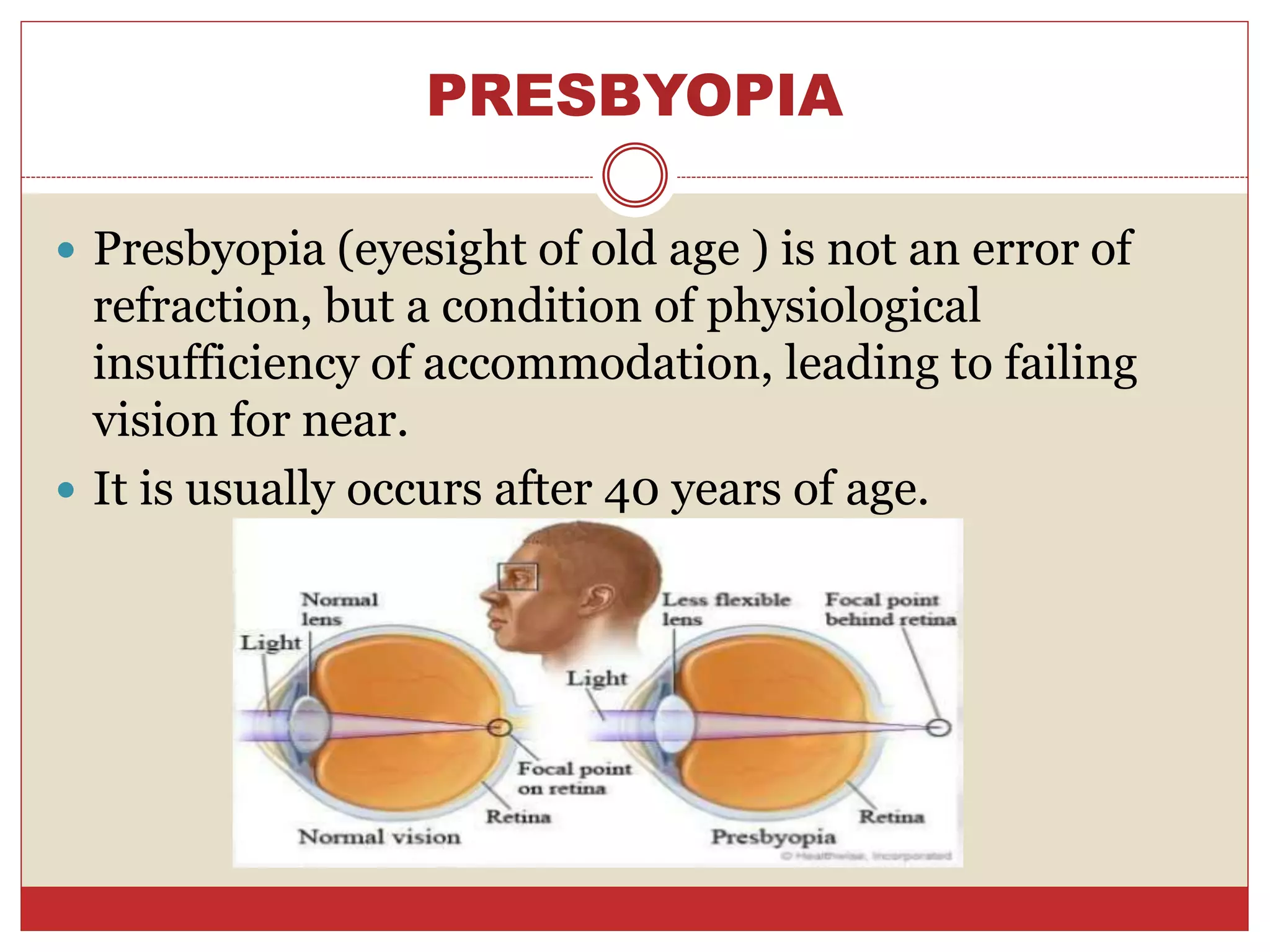 PRESBYOPIA
 Presbyopia (eyesight of old age ) is not an error of
refraction, but a condition of physiological
insufficiency of accommodation, leading to failing
vision for near.
 It is usually occurs after 40 years of age.
 