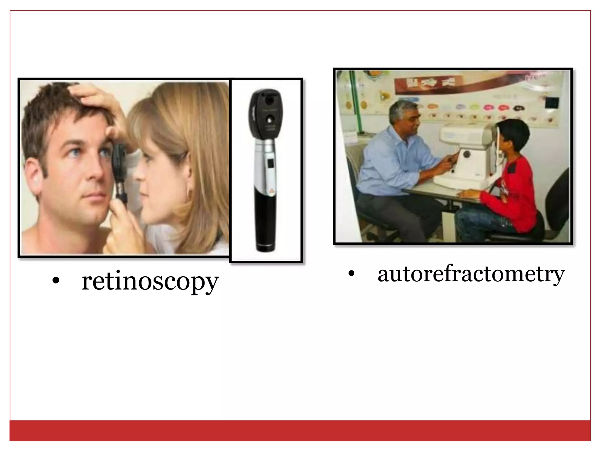 • retinoscopy • autorefractometry
 