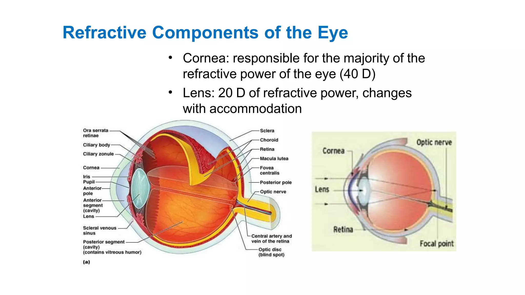 Refractive Components of the Eye
• Cornea: responsible for the majority of the
refractive power of the eye (40 D)
Lens: 20 D of refractive power, changes
with accommodation
•
 