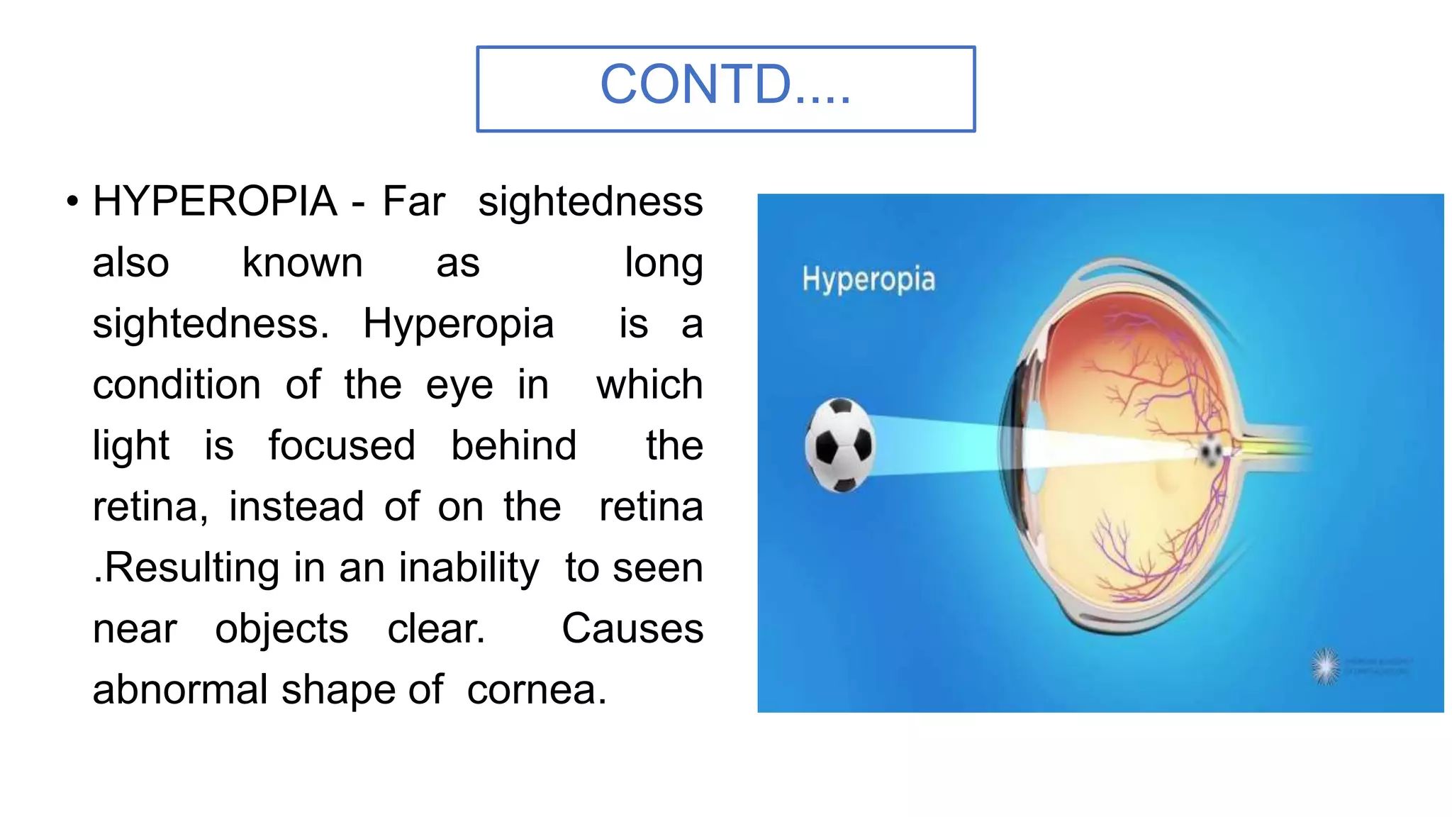 CONTD....
• HYPEROPIA - Far sightedness
also known as long
sightedness. Hyperopia is a
condition of the eye in which
light is focused behind the
retina, instead of on the retina
.Resulting in an inability to seen
near objects clear. Causes
abnormal shape of cornea.
 