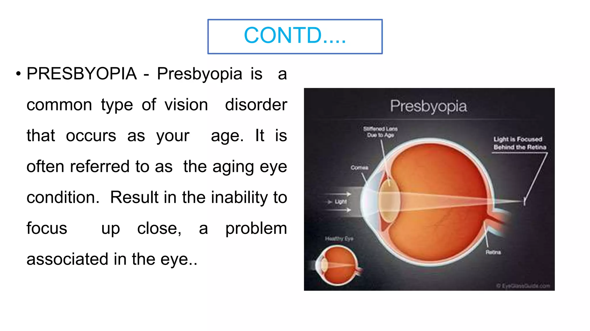 CONTD....
• PRESBYOPIA - Presbyopia is a
common type of vision disorder
that occurs as your age. It is
often referred to as the aging eye
condition. Result in the inability to
focus up close, a problem
associated in the eye..
 