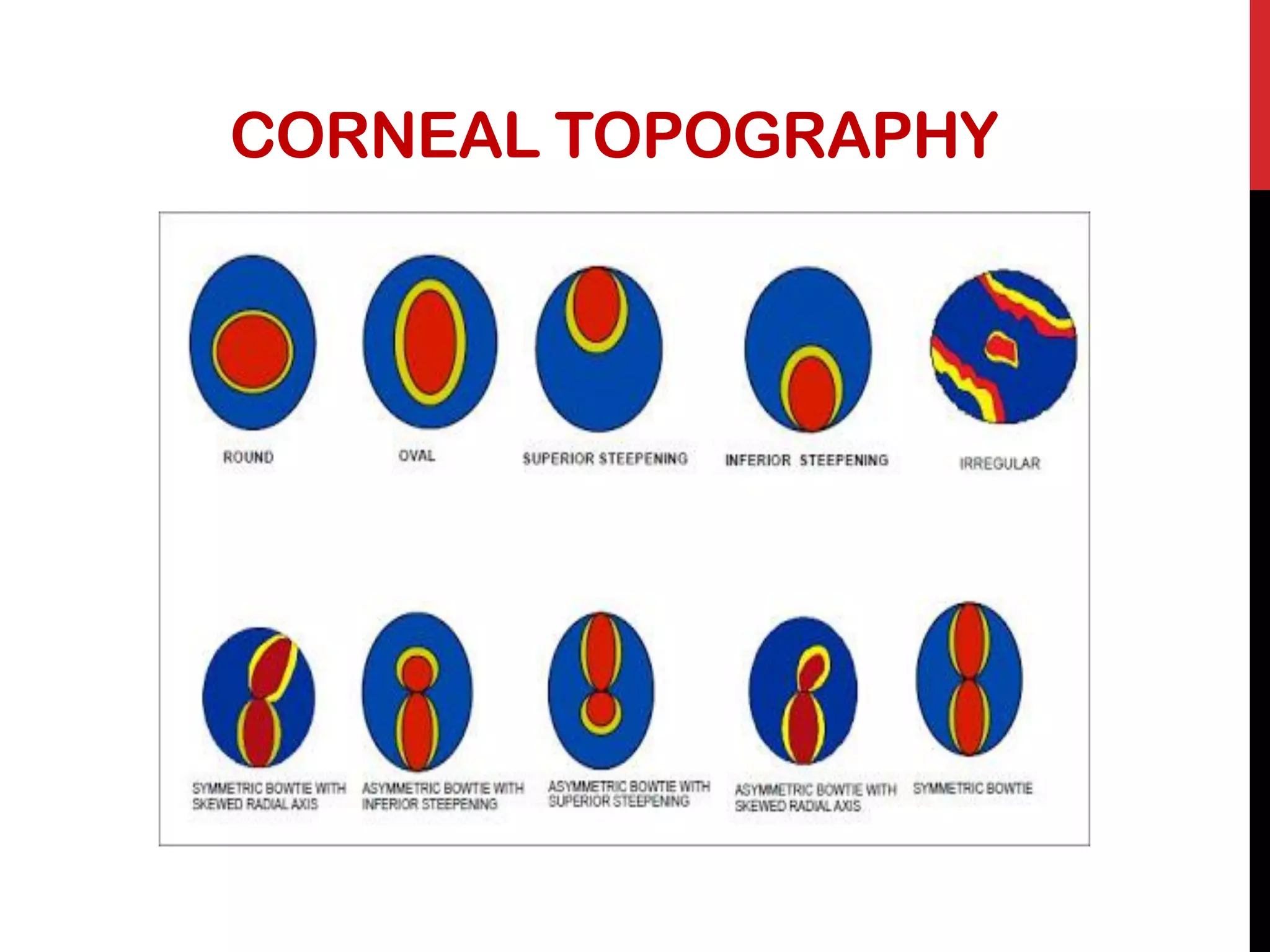 CORNEAL TOPOGRAPHY
 
