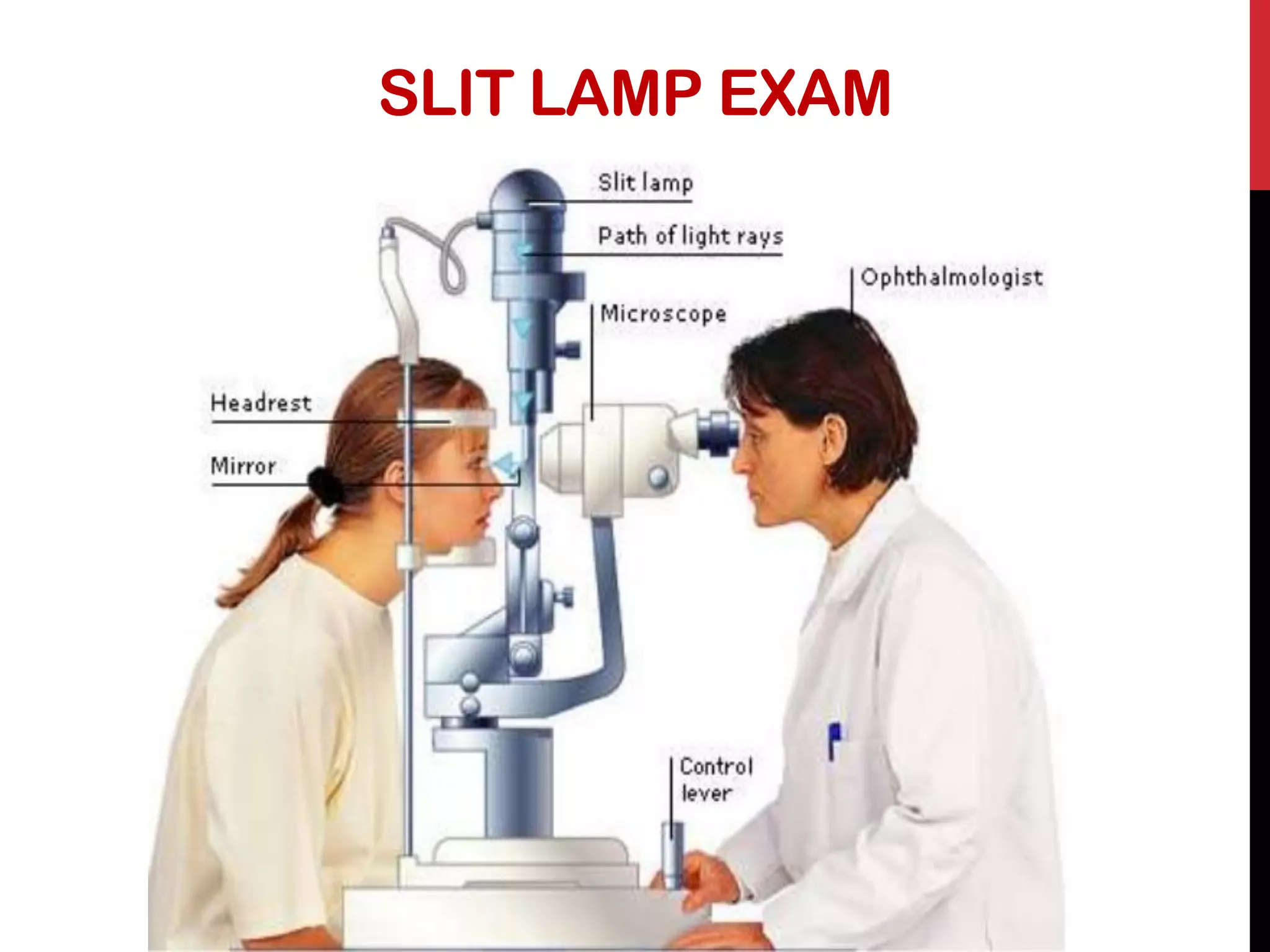 SLIT LAMP EXAM
 
