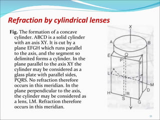 Refraction by cylindrical lenses Fig.  The formation of a concave cylinder. ABCD is a solid cylinder with an axis XY. It is cut by a plane EFGH which runs parallel to the axis, and the segment so delimited forms a cylinder. In the plane parallel to the axis XY the cylinder may be considered as a glass plate with parallel sides, PQRS. No refraction therefore occurs in this meridian. In the plane perpendicular to the axis, the cylinder may be considered as a lens, LM. Refraction therefore occurs in this meridian. 