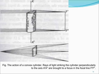 Fig. The action of a convex cylinder. Rays of light striking the cylinder perpendicularly to the axis A'A" are brought to a focus in the focal line F'F". 
