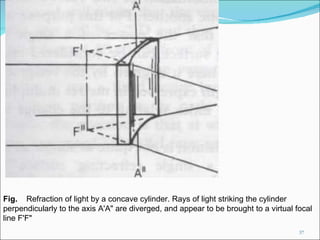 Fig.  Refraction of light by a concave cylinder. Rays of light striking the cylinder perpendicularly to the axis A'A" are diverged, and appear to be brought to a virtual focal line F'F" 