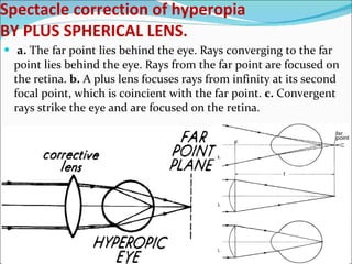 Ophthalmology 5th year, 4th lecture (Dr. Tara) | PPT