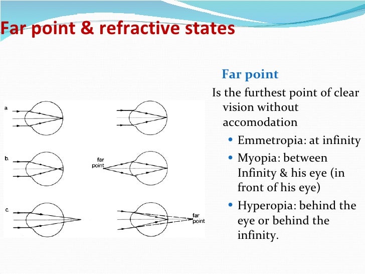 Ophthalmology 5th year, 4th lecture (Dr. Tara)