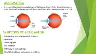 ASTIGMATISM
 It is a condition in which parallel rays of light come from infinity doesn’t focus on a
point due to refraction varies in different meridians,when accommodation is at rest.
SYMPTOMS OF ASTIGMATISM
~ Distorted or blurred vision at all distances
~ Headache
~ Squinting eyes
~ Eye irritation
~ Difficulty in seeing at night
~ Head tilt in oblique astigmatism in children
 