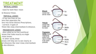 TREATMENT
BIFOCAL LENSES
~Used for both Near vision
& Distance Vision.
TRIFOCAL LENSES
~It has two lines on the
lens that separates the
lens into three distinct Prescriptions.
~corrects 3 types of
Vision like close,intermediate & distance.
PROGRESSIVE LENSES
~Also called as no line multifocal
lenses that looks exactly as single
vision lenses.
~In other words,these
lenses will help one to see clearly at
all distances like near/close,intermediate
& also distance.
 