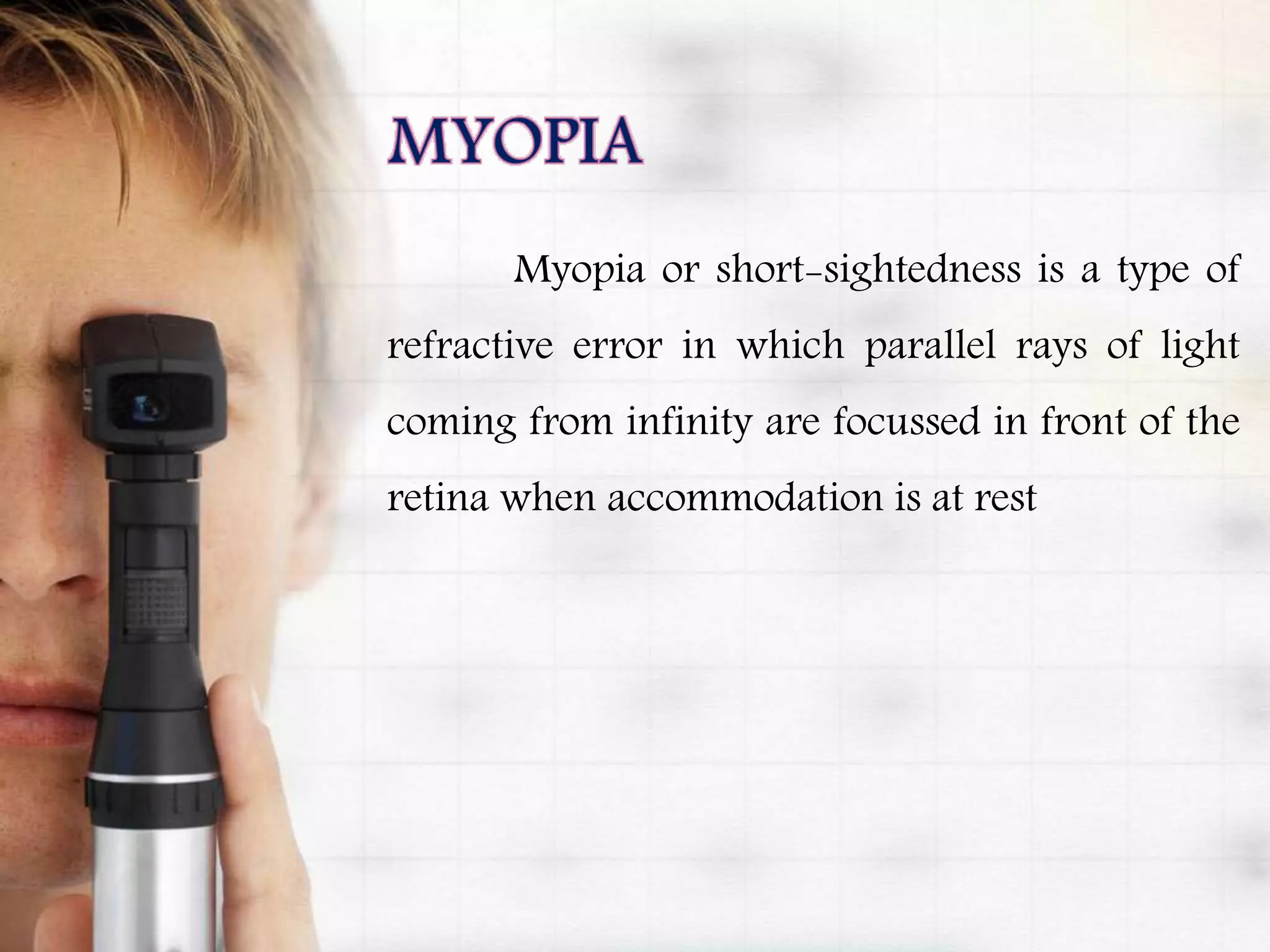 Myopia or short-sightedness is a type of
refractive error in which parallel rays of light
coming from infinity are focussed in front of the
retina when accommodation is at rest
 